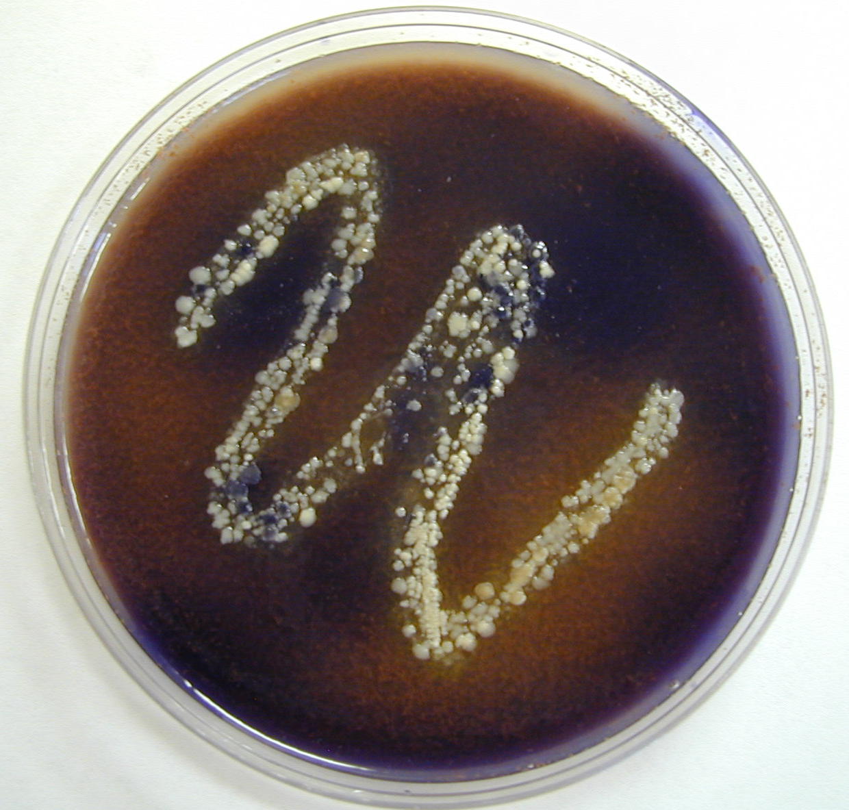 Selective and Diff Media List